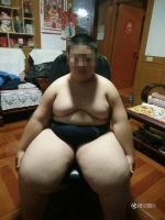 辽宁10岁男孩182斤坐着睡3年 母亲求支招救儿子一命 - 中国在线