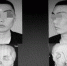 3D打印技术还原小伙正常的脸 - Syd.Com.Cn